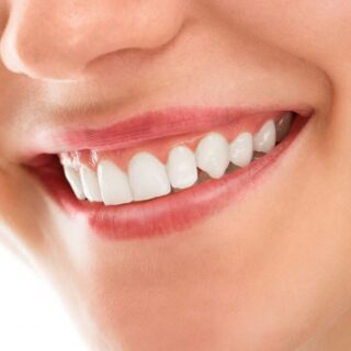 امرأة بالغة تبتسم وتظهر اسنانها ناصعة البياض