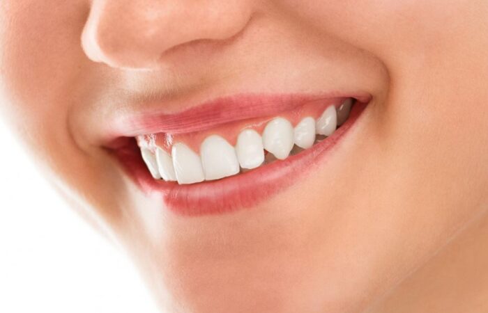 امرأة بالغة تبتسم وتظهر اسنانها ناصعة البياض