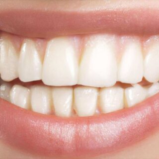 أسنان بشرية ناصعة البياض وهي تظهر داخل فم فتاة مبتسمة