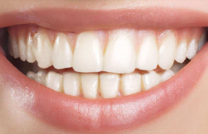 أسنان بشرية ناصعة البياض وهي تظهر داخل فم فتاة مبتسمة