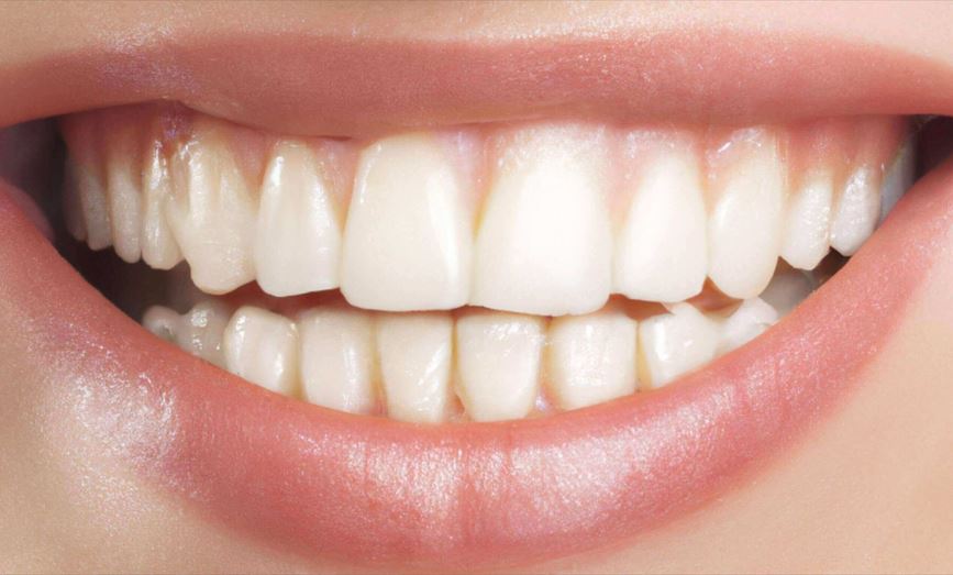 أسنان بشرية ناصعة البياض وهي تظهر داخل فم فتاة مبتسمة