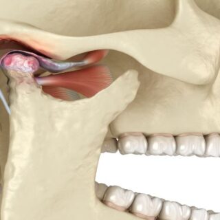 رسم تشريحي لعظام الفك عند الإنسان ويظهر المفصل الفكي الصدغي والأربطة العضلية المجاورة له