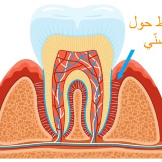 رسم تشريحي للسن ويظهر تاج السن، اللثة وجذر السن بالإضافة الى سهم توضيحي لموضع الرباط حول السنّي
