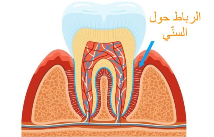 رسم تشريحي للسن ويظهر تاج السن، اللثة وجذر السن بالإضافة الى سهم توضيحي لموضع الرباط حول السنّي