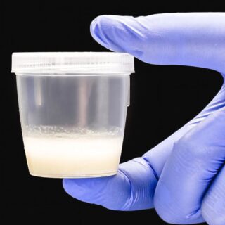 يد تلبس قفاز مطاطي أزرق اللون وتحمل علبة شفافة بداخلها سائل أبيض اللون