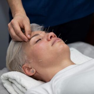 فتاة تلبس كنزة بيضاء تستلقي على ظهرها مغمضة العينين وهناك شخص خلفها يقوم بغز الإبر الصينية في وجهها