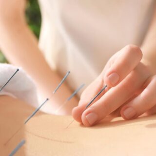 فتاة تلبس كنزة بيضاء تقوم بوخز إبر صينية في اسفل ظهر انسان آخر