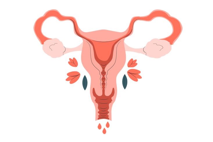 رسم توضيحي للجهاز التناسلي لدى المرأة باللون الزهري ويظهر المبيض والرحم وثلاث نقاط حمراء اسفل الرحم دلالة على غزارة الدورة الشهرية