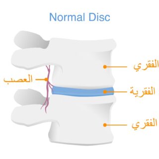 رسم توضيحي لمقطع طولي لفقرتين في العمود الفقري عند الإنسان وتظهر القرص الفقرية بين الفقرات