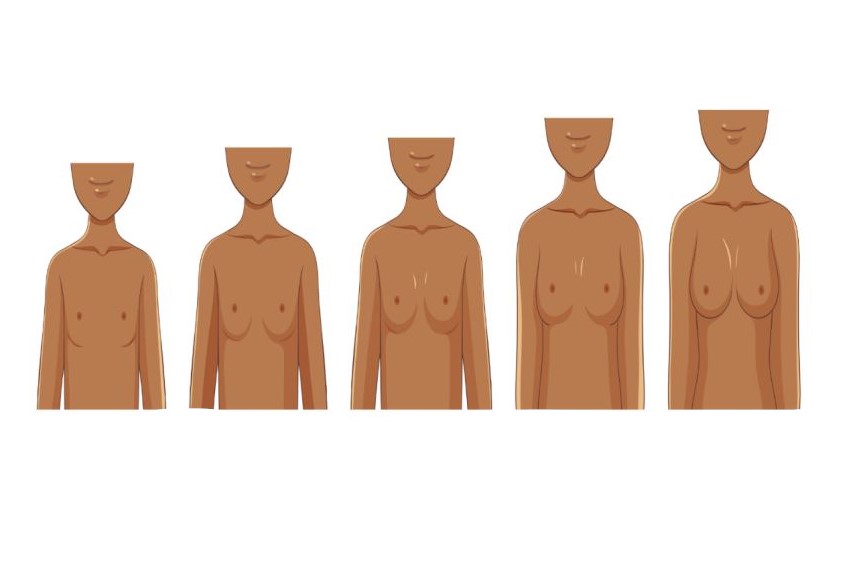 رسم توضيحي لمراحل تطور نمو الثدي عند الفتاة عند البلوغ