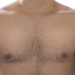 صدر فتى بالغ ويظهر شعر الصدر لديه وقد بدأ بالنمو حديثا
