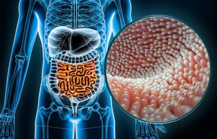 رسم تشريحي للجهاز الهضمي لدى الإنسان وتظهر صورة مكبرة للزغابات المعوية على شكل أهداب وردية اللون بجانب بعضها البعض