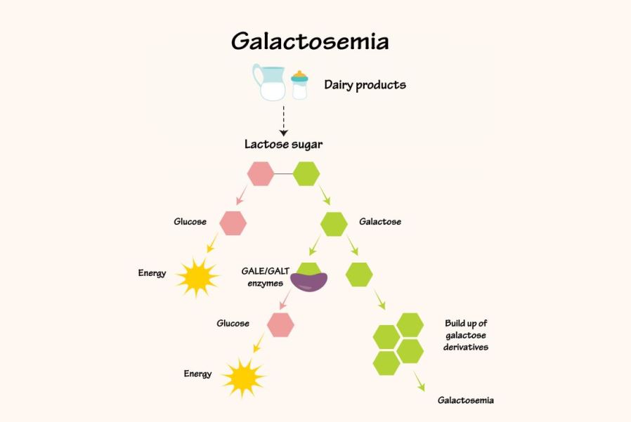 رسم توضيحي لتفاعل الغالاكتوزيميا