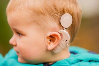 جهاز الحلزون أو القوقعة لتقوية السمع مزروع على رأس طفل صغير
