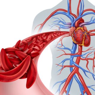 رسم توضيحي للشريان الدموي عند الإنسان وتوجد فيه كريات حمراء