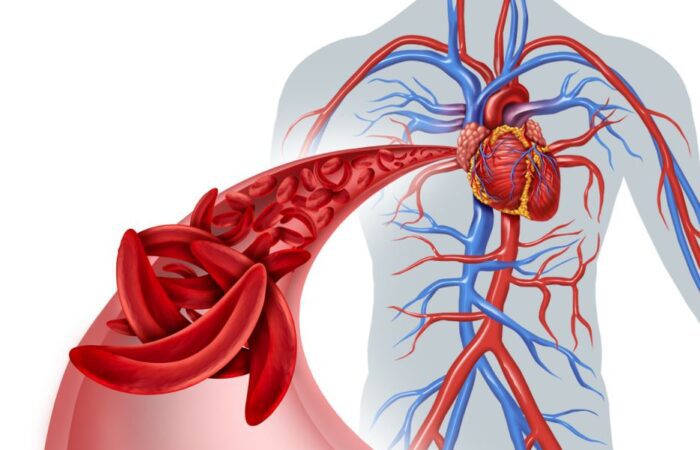 رسم توضيحي للشريان الدموي عند الإنسان وتوجد فيه كريات حمراء