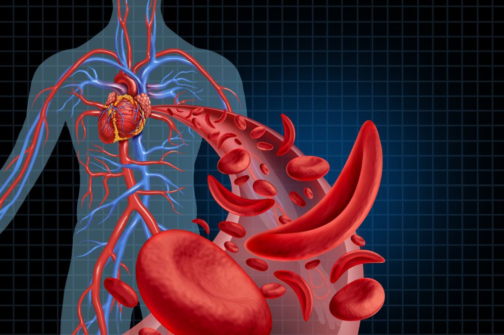 رسمة توضيحية للدورة الدموية عند الإنسان ويظهر القلب والأوردة والشرايين وتظهر من الشرايين كريات الدم الحمراء وهي مقوسة على شكل المنجل