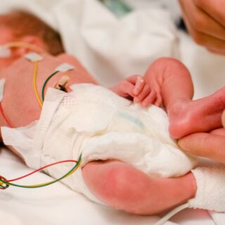 طفل خديج موجود في حضانة المستشفى موصول به العديد من الأسلاك