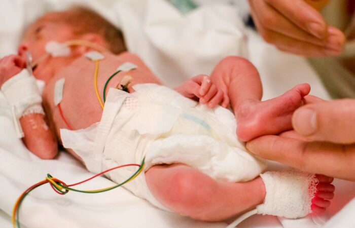 طفل خديج موجود في حضانة المستشفى موصول به العديد من الأسلاك