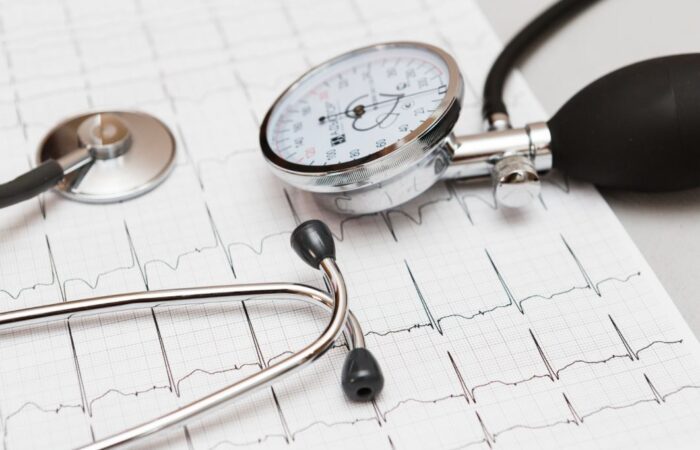 جهاز قياس ضغط الدم التقليدي وسماعات الطبيب على ورقة رسم بياني لتخطيط القلب