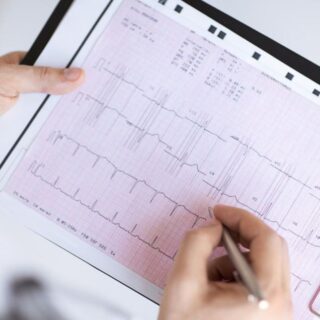 طبيب يحمل ورقة تخطيط بياني للقلب