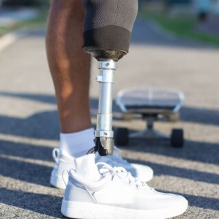شخص مبتور الساق له قدم اصطناعية فضية اللون ويرتدي حذاء رياضي