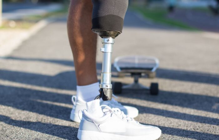 شخص مبتور الساق له قدم اصطناعية فضية اللون ويرتدي حذاء رياضي