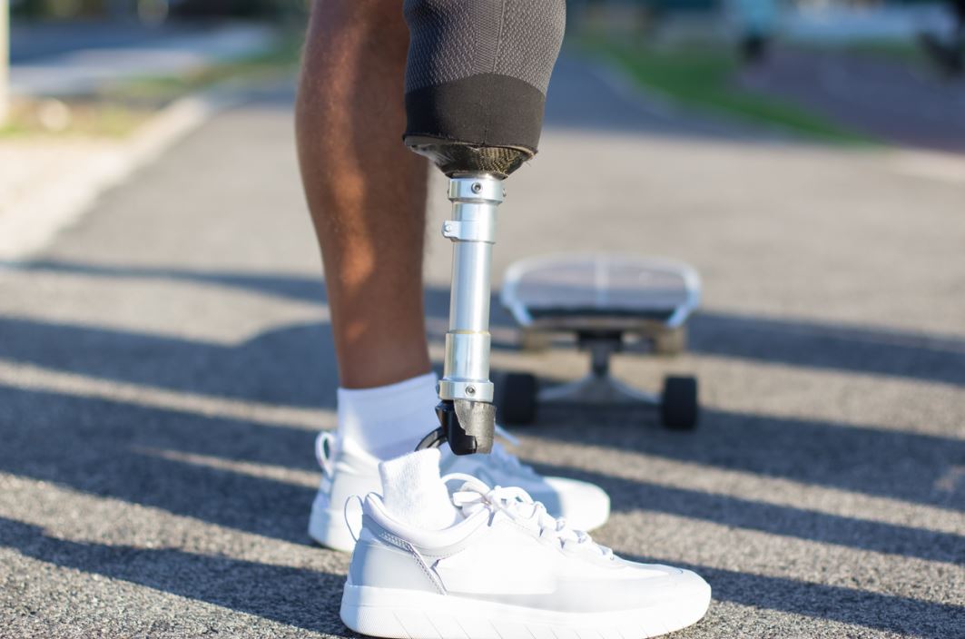 شخص مبتور الساق يلبس قدم اصطناعية