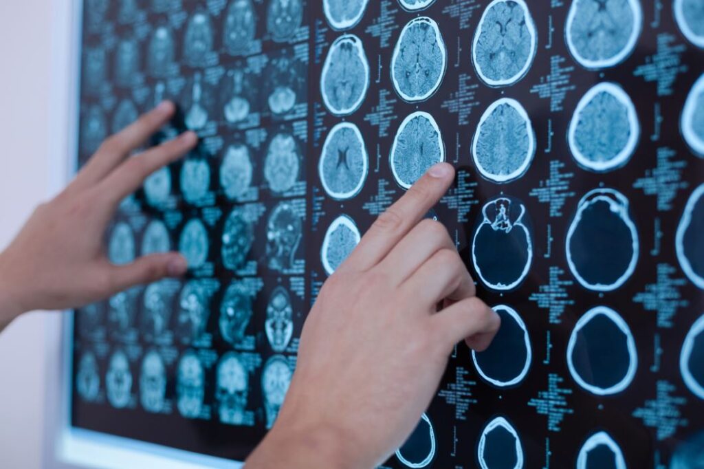 شخص يقوم بقراءة صورة شعاعية موجودة على جدار مضيئ
