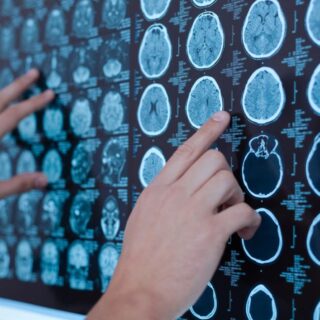 شخص يقوم بقراءة صورة شعاعية موجودة على جدار مضيئ