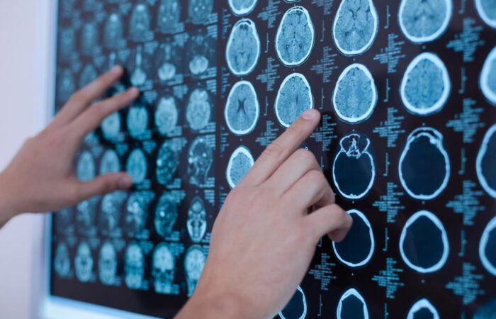شخص يقوم بقراءة صورة شعاعية موجودة على جدار مضيئ