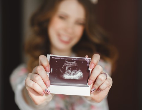 امرأة في الثلث الأول من الحمل تمسك صورة سوار للجنين