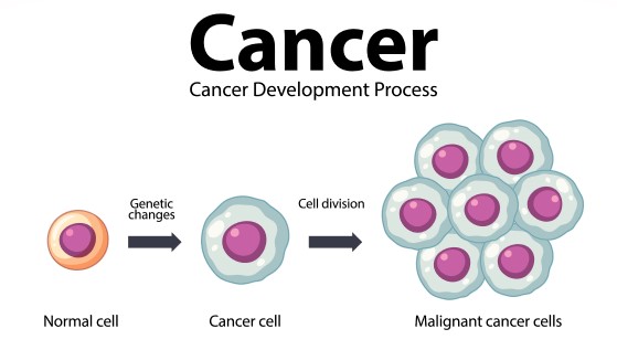 خلية سليمة وخلية مصابة بالسرطان