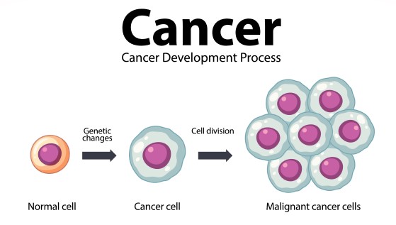 رسم توضيحي لخلية سليمة وخلية مصابة بالسرطان