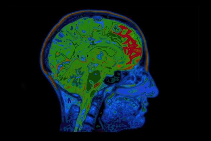 صور لرأس الإنسان مأخوذة باستخدام التصوير بالرنين المغناطيسي النووي