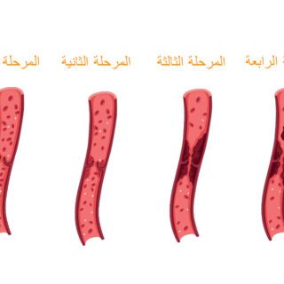 المراحل الأربعة لآلية التخثر الطبيعية