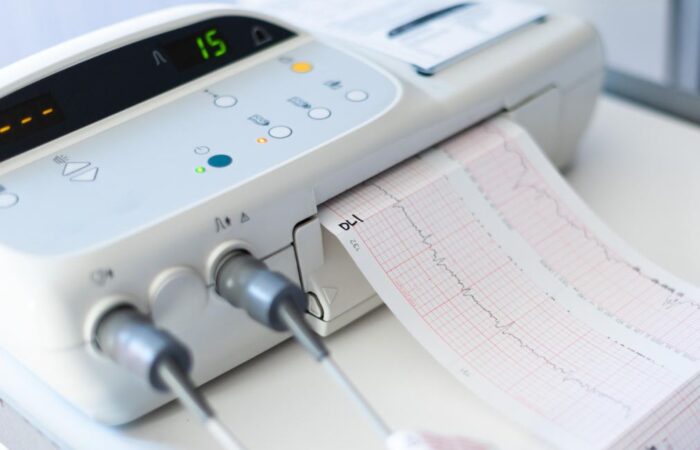 جهاز تخطيط القلب الكهربائي على شكل جهاز أبيض له شاشة مستطيلة سوداء وتخرج من الجهاز ورقة مخططة بخطوط حمراء وفي منتصفها خط بياني متعرج