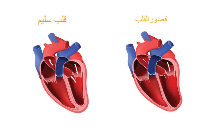 رسم توضيحي لتجويف قلب الإنسان وتظهر بداخله أسهم تشير لاتجاه تدفق الدم به