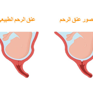 رسم توضيحي لرأس الجنين داخل الرحم
