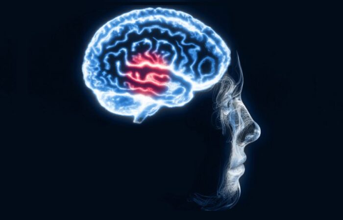 رسم توضيحي لدماغ يعاني من رضّة