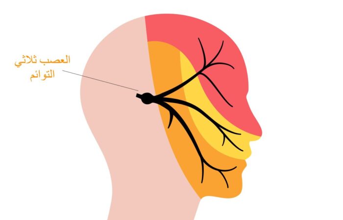 رسم توضيحي للعصب ثلاثي التوائم وهو مار بالوجه عند الإنسان
