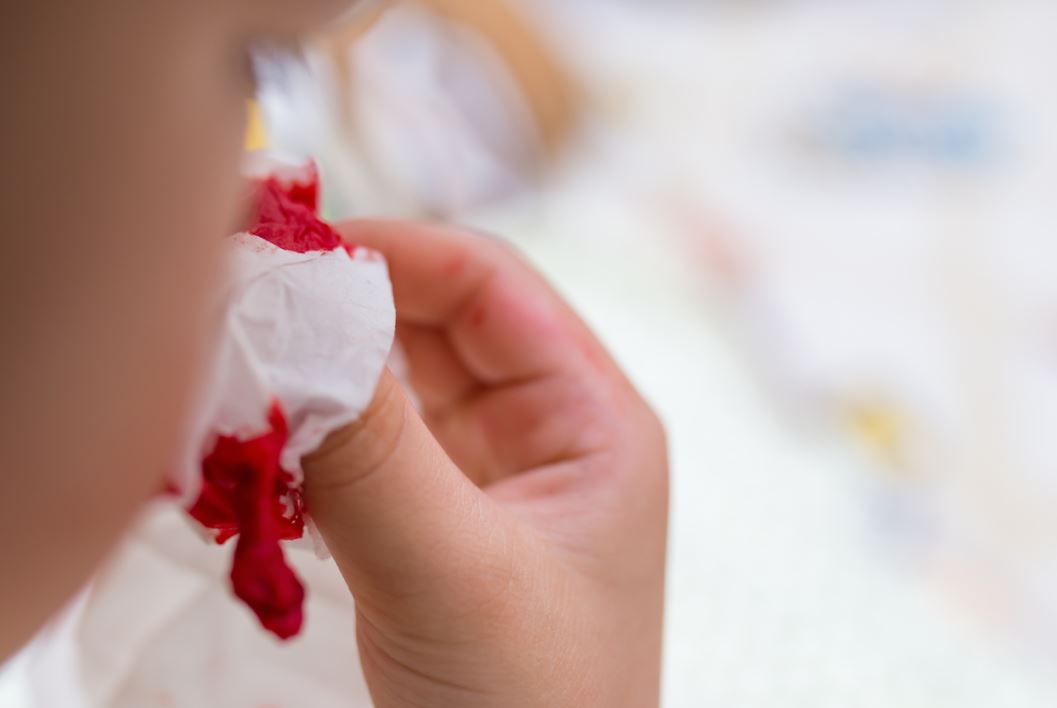طفل ينزف دم من أنفه