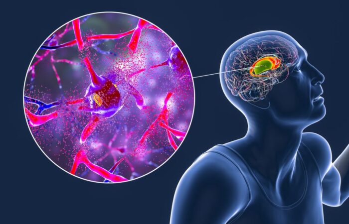 رسم توضيحي لكتلة متواجدة في الدماغ البشري