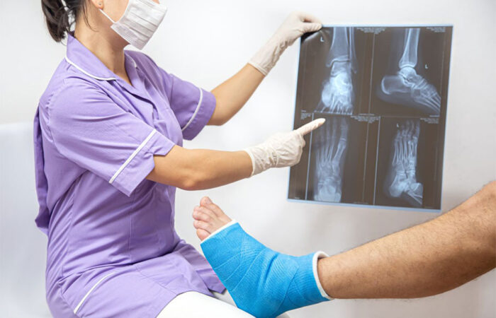 طبيبة تقوم بعرض صورة شعاعية على مريض يجلس أمامها ويضع ضمادة زرقاء على كاحله