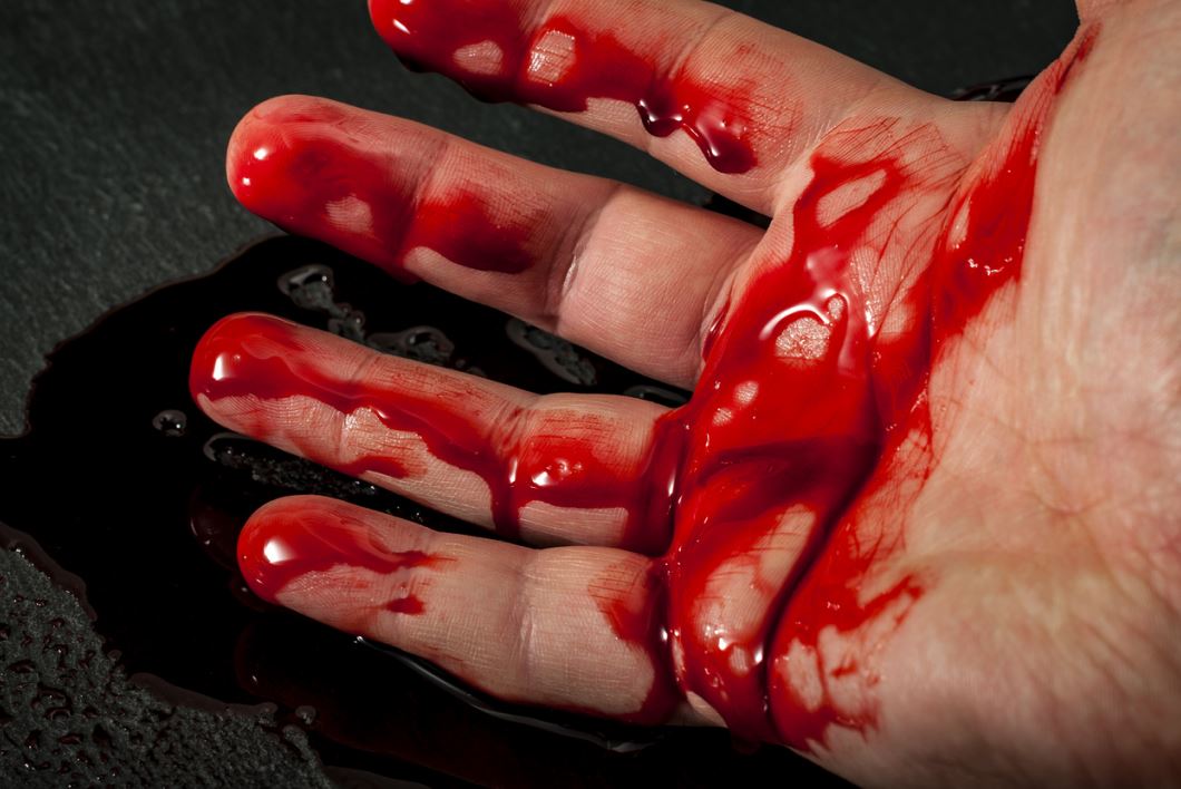 يدّ تنزف كمية كبيرة من الدم