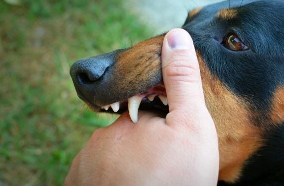 كلب يغرز أسنانه بيد شخص