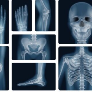 رسم توضيحي للصور الشعاعية