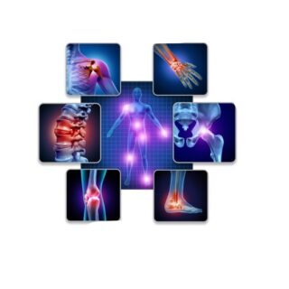 رسم توضيحي لتوزع بقع حمراء على مفاصل مختلفة في الجسم