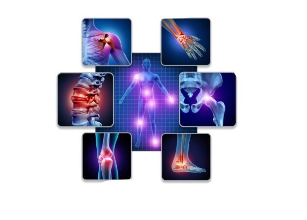 رسم توضيحي لتوزع بقع حمراء على مفاصل مختلفة في الجسم