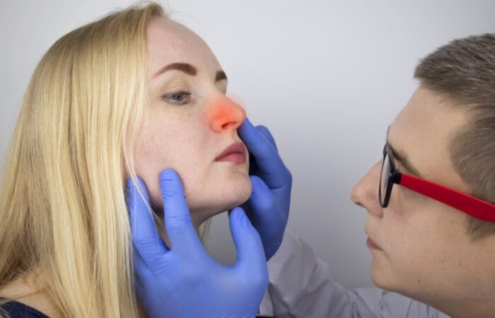 طبيب يرتدي كفوف زرقاء يفحص أنف امرأة شقراء